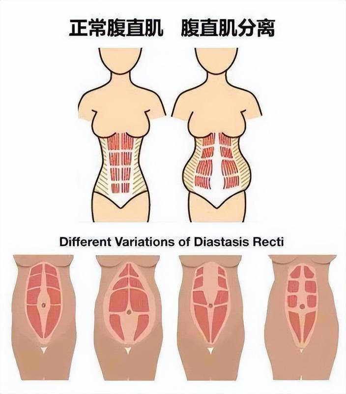  产后修复顺序深度拆解：从生理机制到实操路径的完整闭环 健康养生